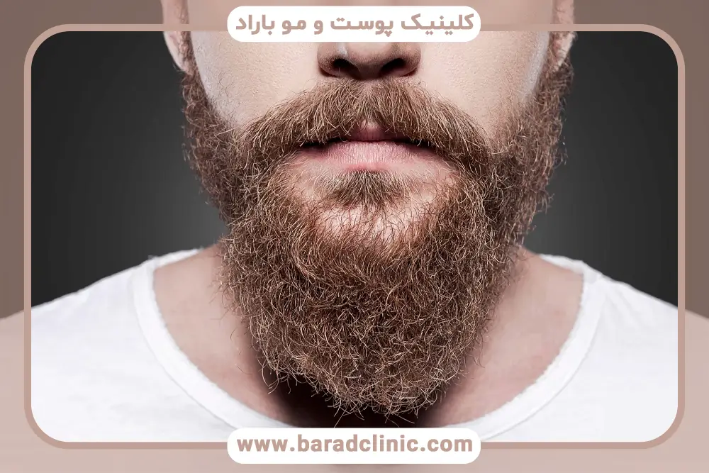 آمادگیهای قبل از عمل کاشت ریش