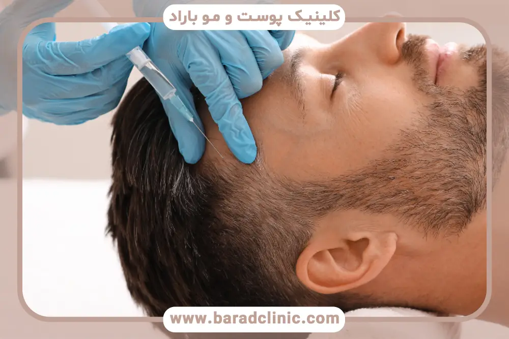 برای مزوتراپی مو کجا برم؟ معیارهای انتخاب