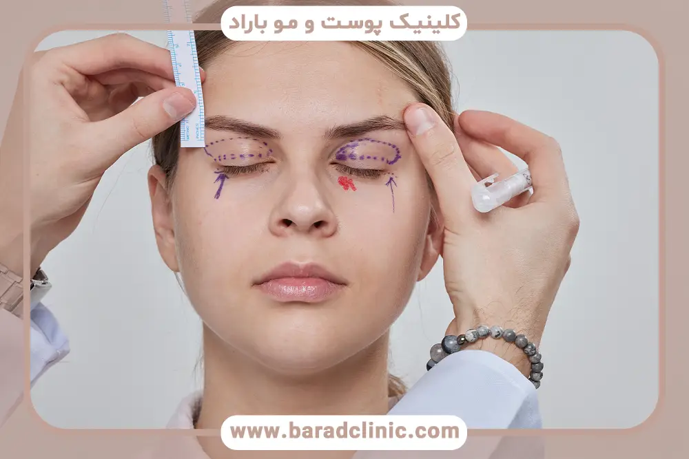 بررسی تکنولوژی‌ها از مهم‌ترین معیارهای بهترین مرکز بلفاروپلاستی در تهران 