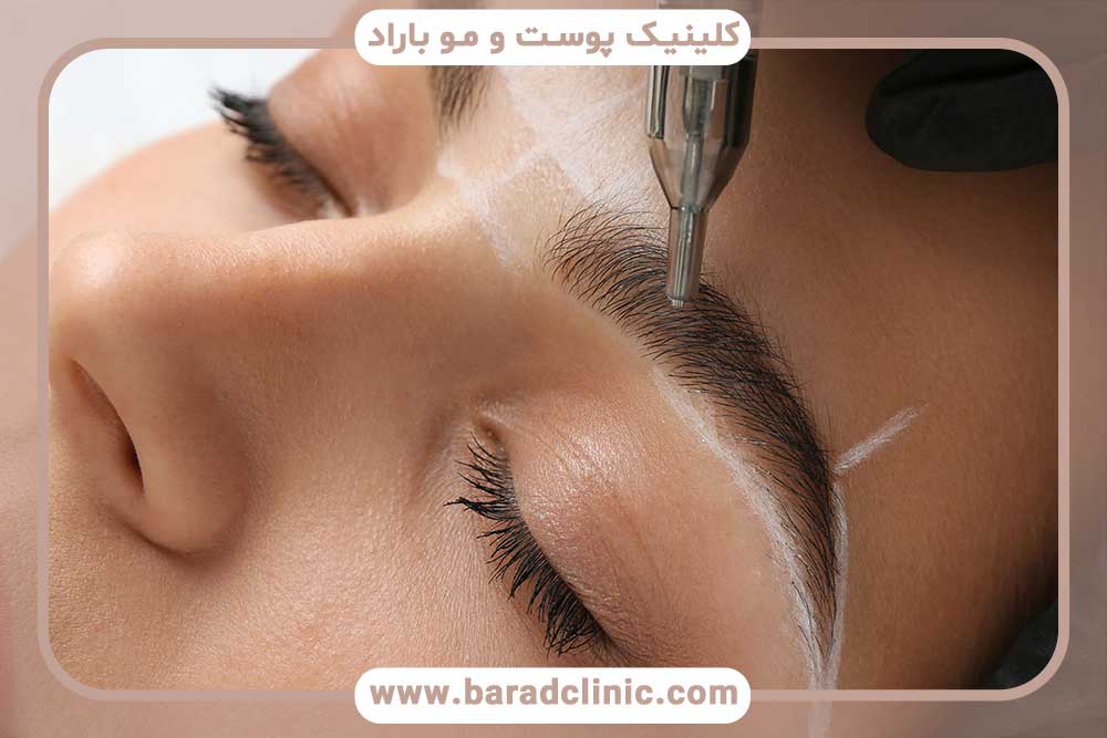بهترین کلینیک تخصصی کاشت ابرو