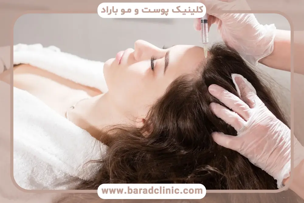 مراحل مزوتراپی برای پرپشتی مو