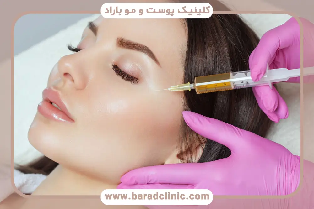 جداسازی پلاکت‌ها در پی آر پی