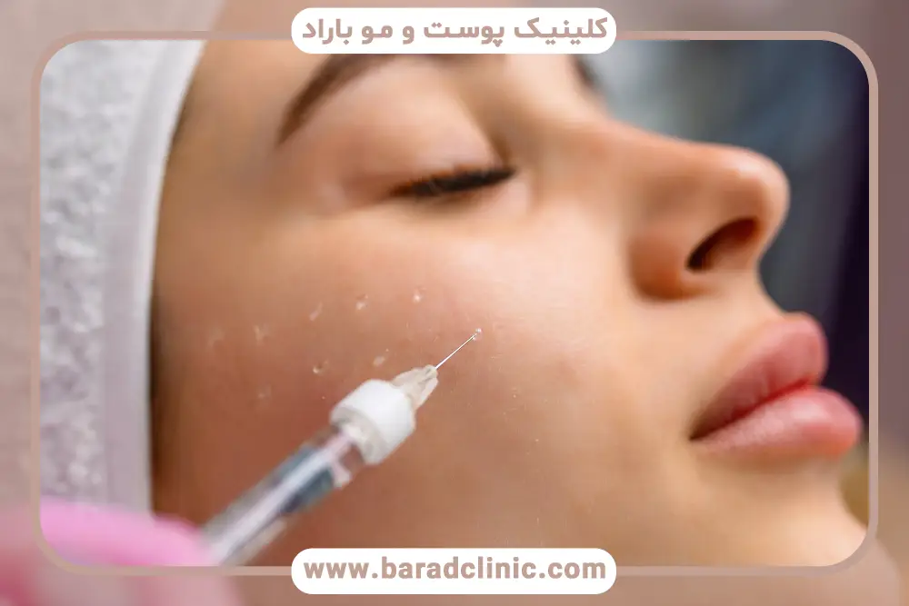 برای مزوتراپی صورت چند سی سی لازم است؟ عوامل موثر