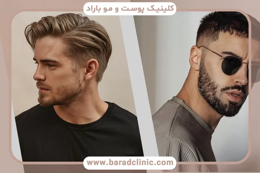 شهرهای معروف برای بهترین کاشت مو در ایران