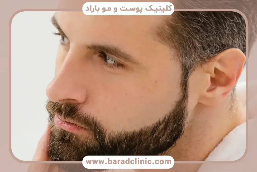 تحلیل روند بهبودی در نمونه کاشت ریش