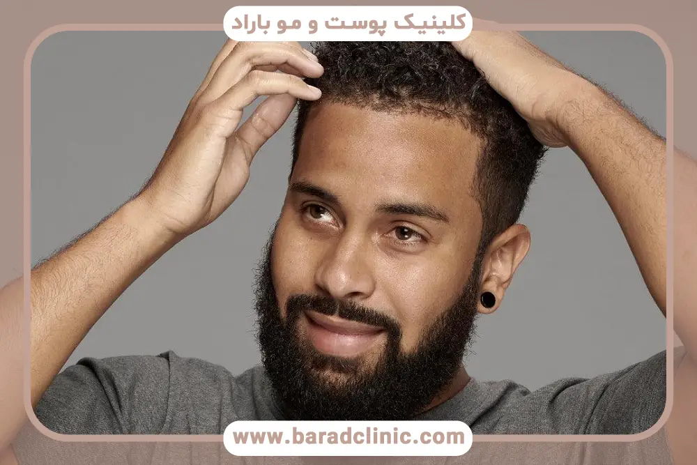 عوارض و ریسکها در تبلیغات کاشت مو