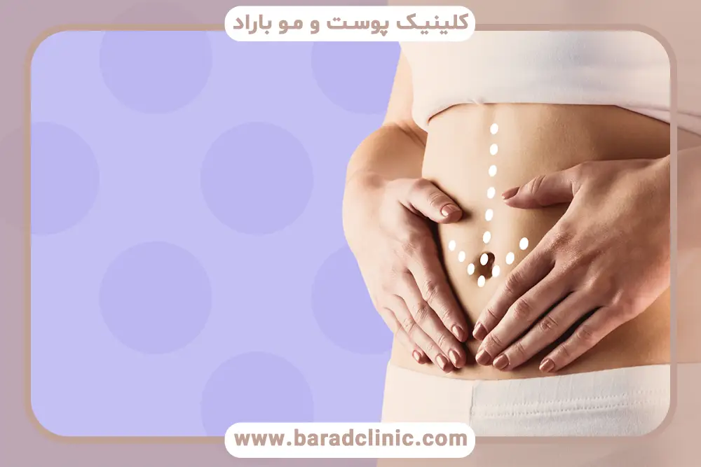 نقش بوتاکس معده در کنترل پرخوری عصبی