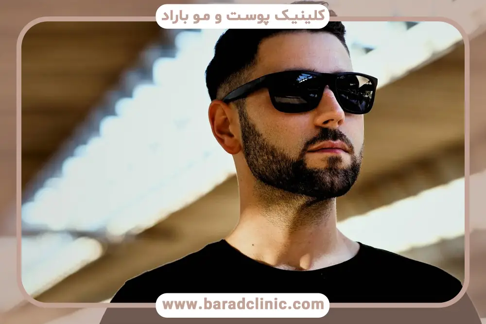 مراقبتهای بعد از عمل کاشت ریش