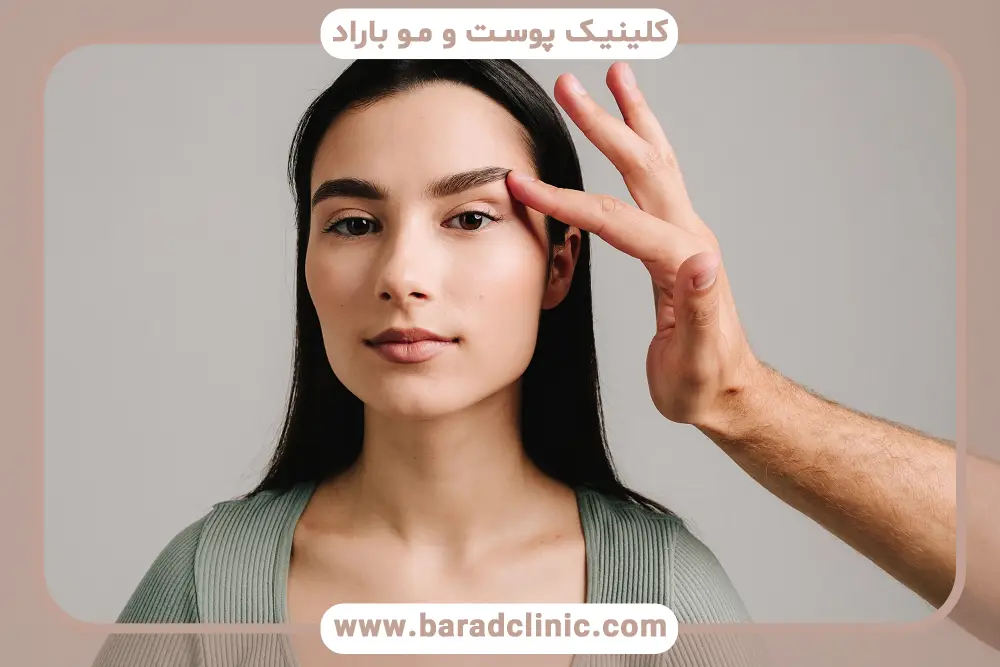 تصاویر و نمونه‌های نتیجه نهایی عمل بلفاروپلاستی 