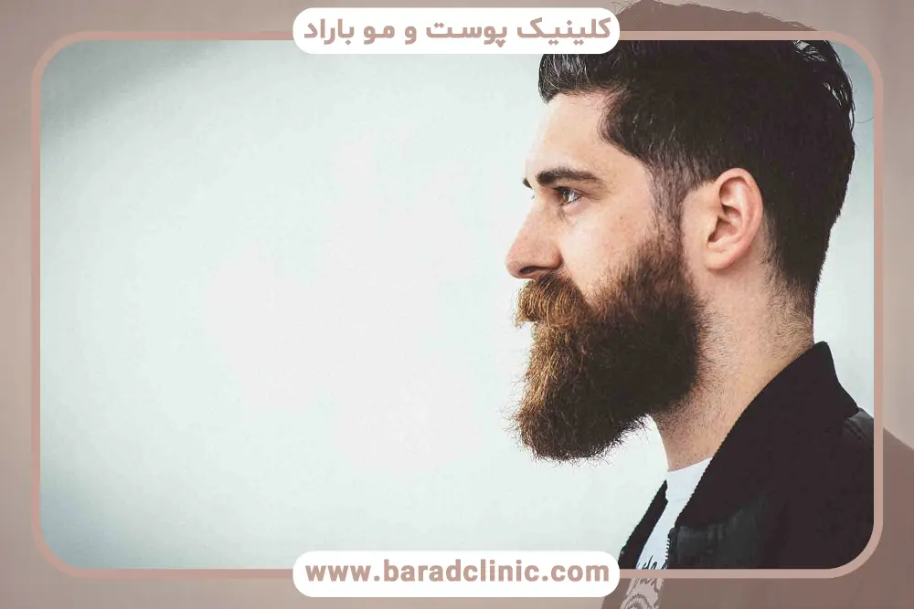 میزان درد کاشت ریش به روش fit