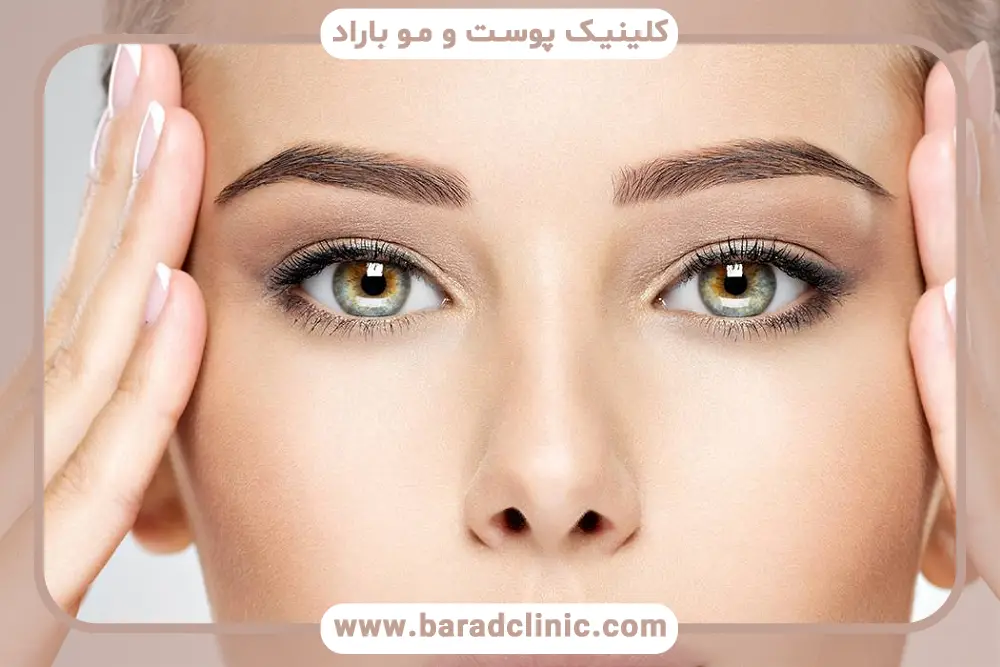 مراقبتهای قبل و بعد بلفاروپلاستی بدون بخیه