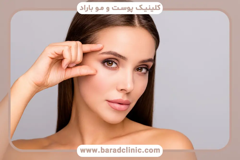 تاثیر عمل بلفاروپلاستی بدون بخیه بر جوانسازی صورت