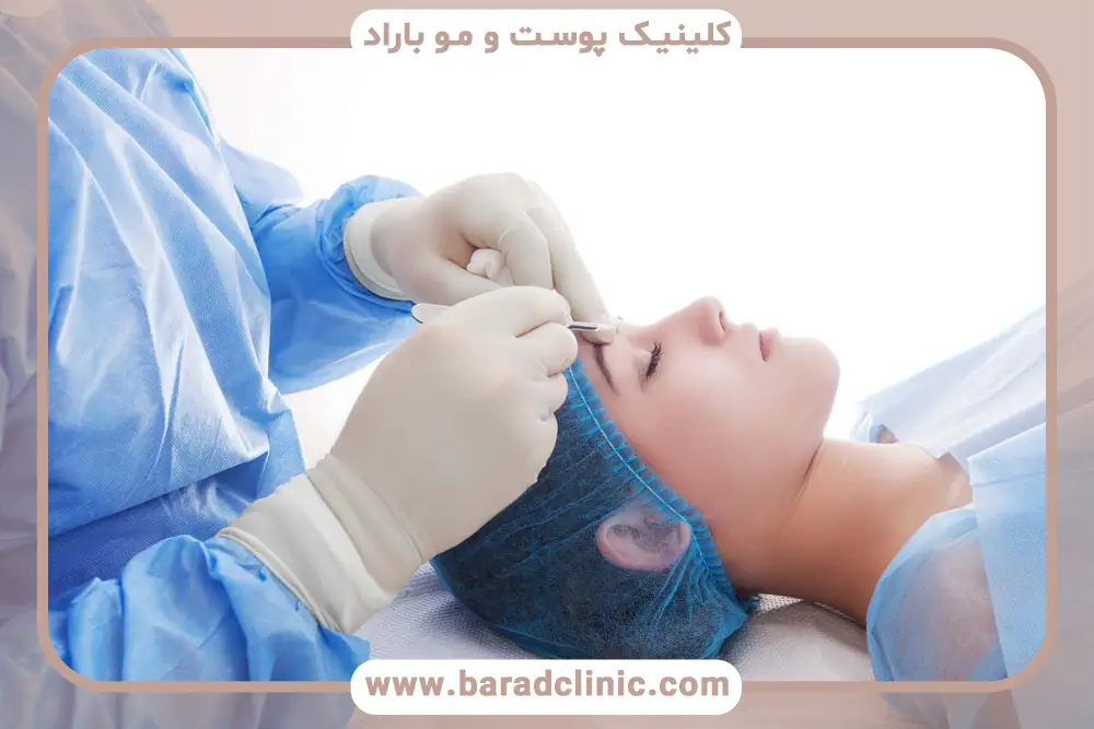 نکات مراقبتی برای پیشگیری از بروز عوارض بلفاروپلاستی