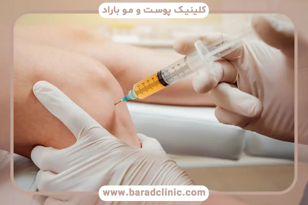 مدت زمان تزریق پی آر پی