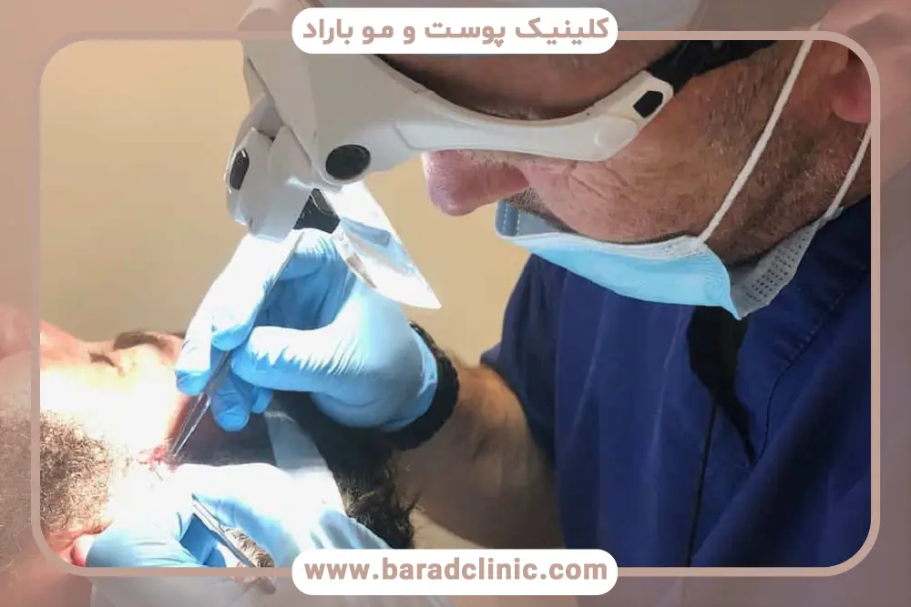 بررسی نمونه کارهای کلینیک کاشت ریش تهران