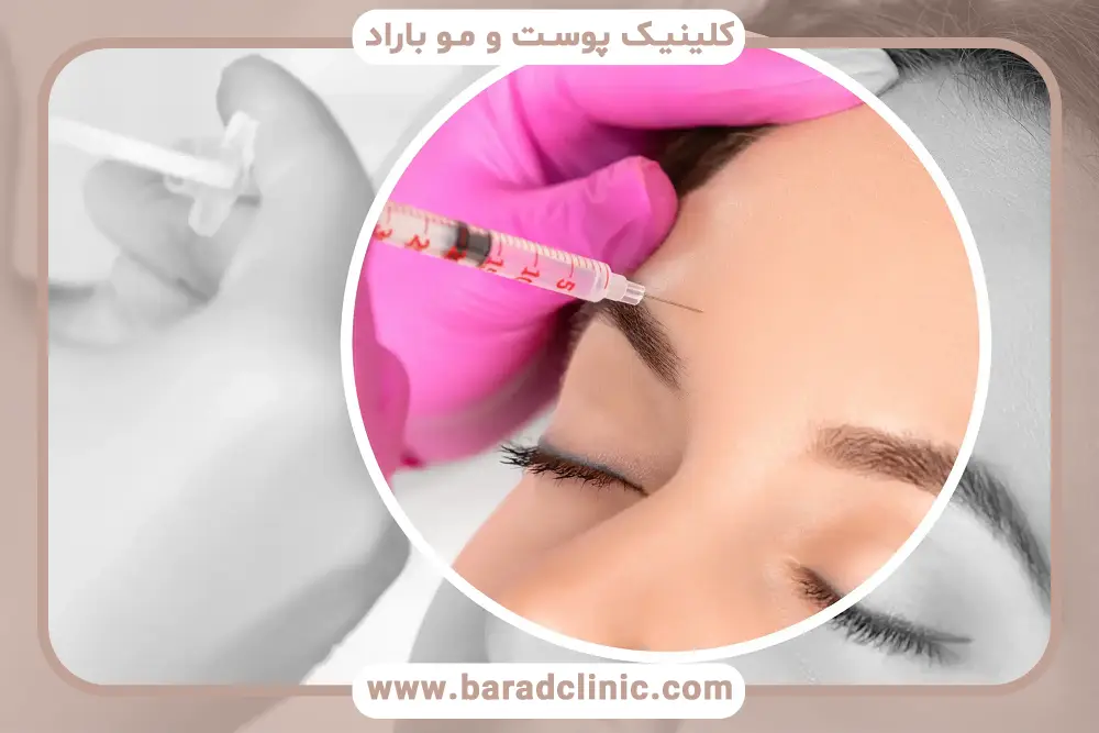 کاندیدای مناسب بوتاکس