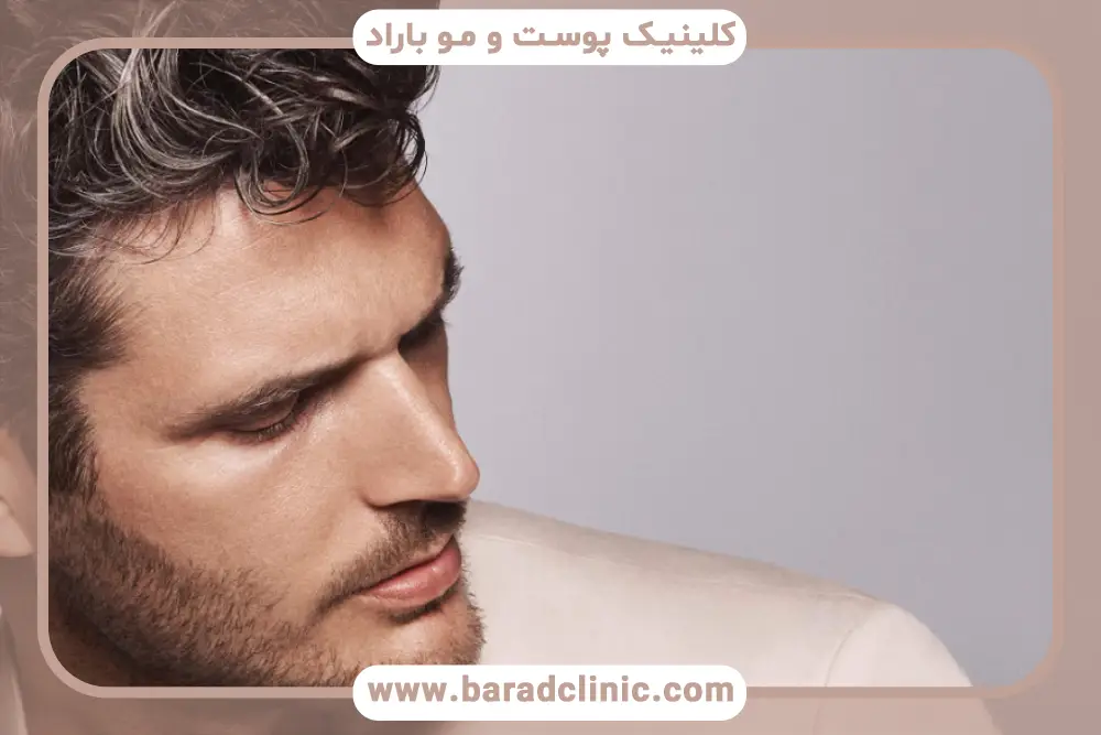 تجربه بیماران در فیلم کاشت مو به روش سلولهای بنیادی