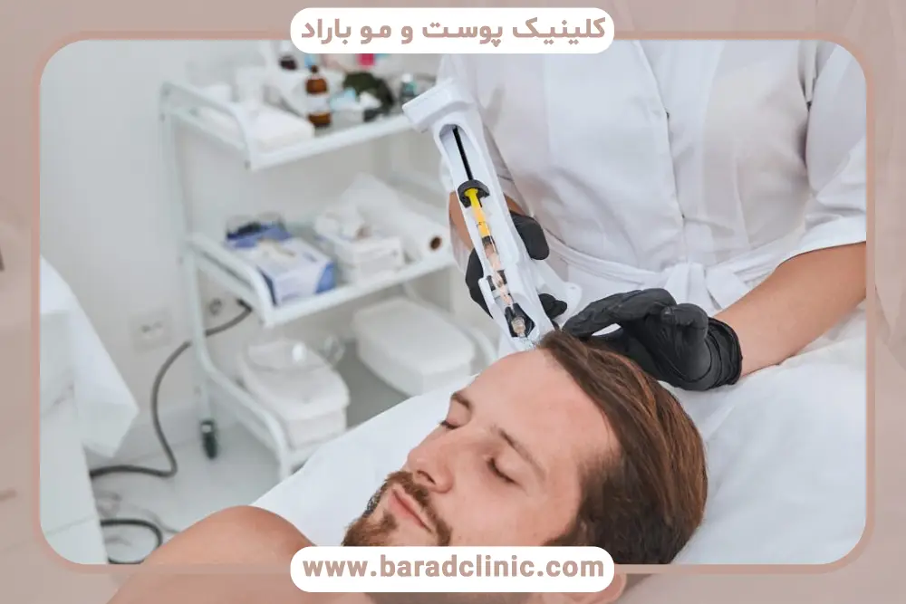 مراقبت‌های قبل و بعد مزوتراپی برای ریزش هورمونی مو