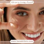 کاشت ابرو قبل و بعد