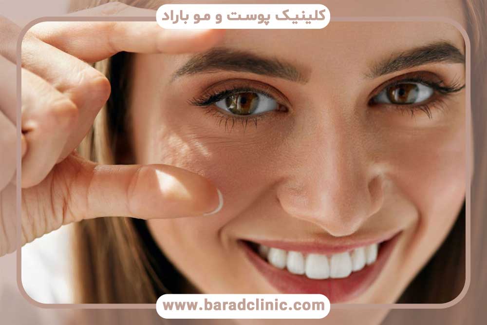 کاشت ابرو قبل و بعد