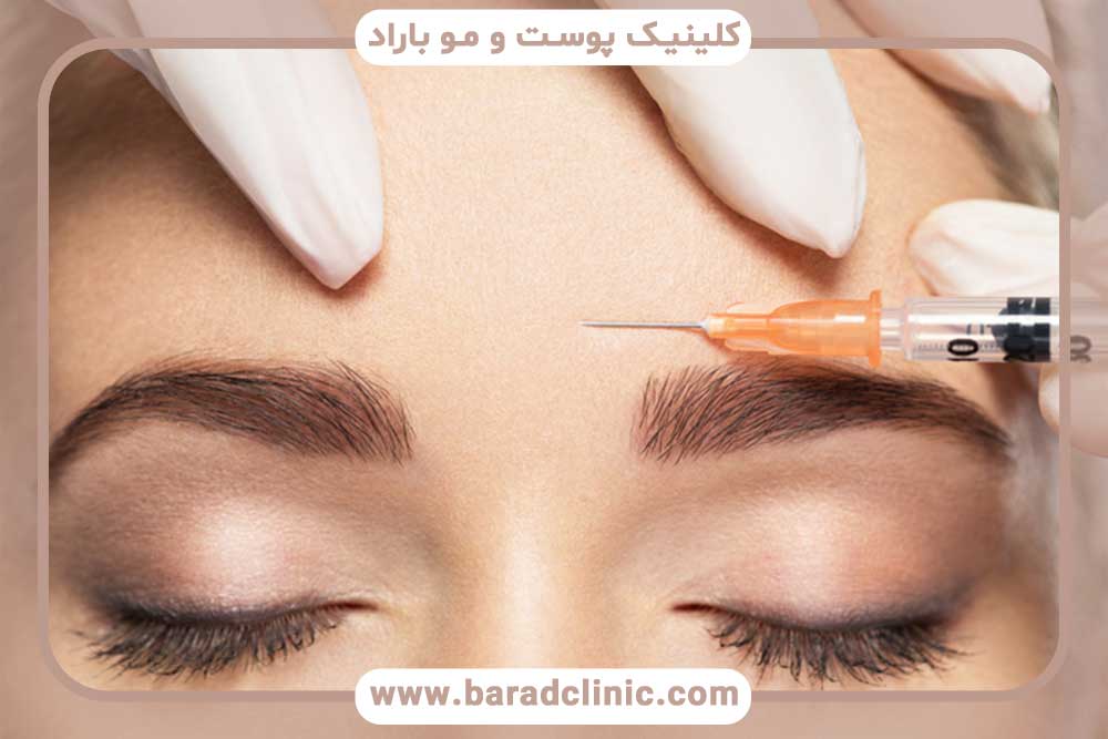 تزریق بی‌حسی قبل از کاشت ابرو