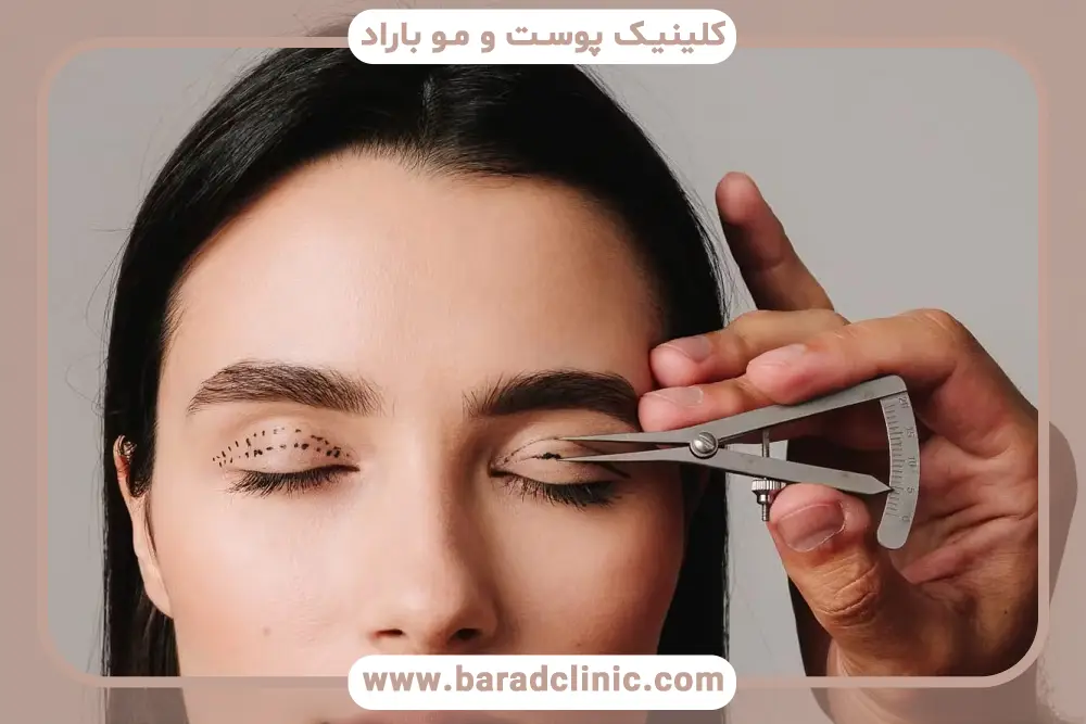 انواع تکنیک های برش در بلفاروپلاستی