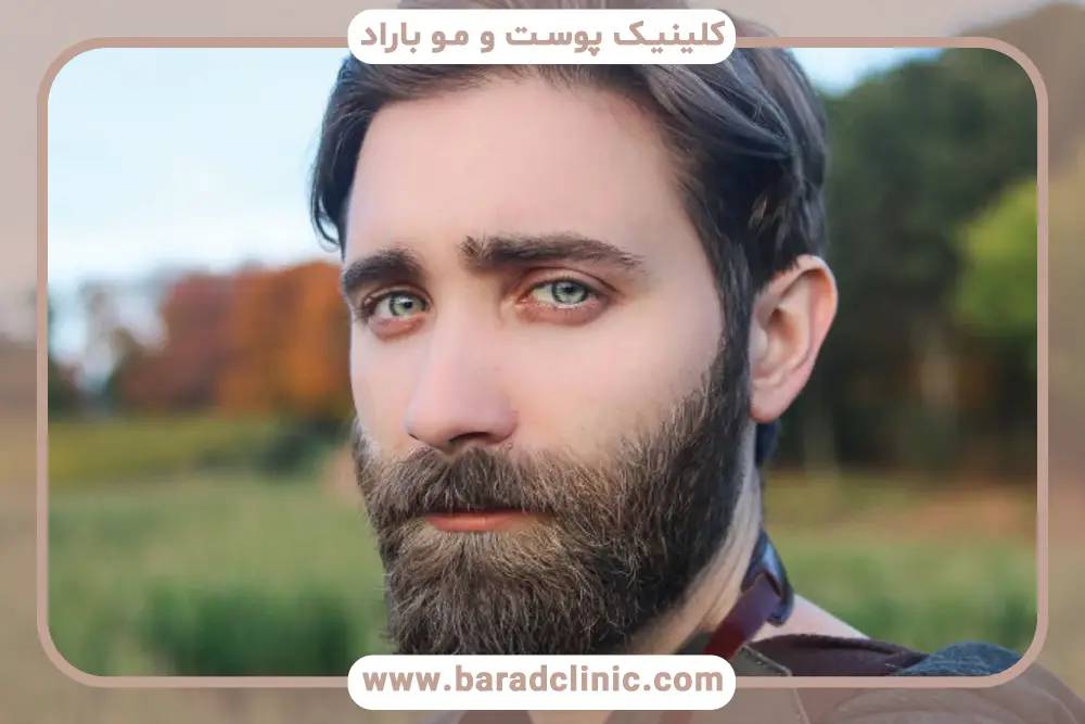 بهترین کلینیک تخصصی کاشت ریش در تهران