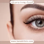 روش برش زیر خط مژه