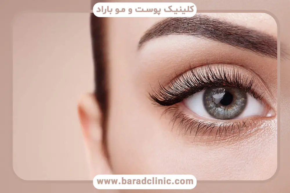 روش برش زیر خط مژه