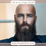کاشت ریش به روش DHI