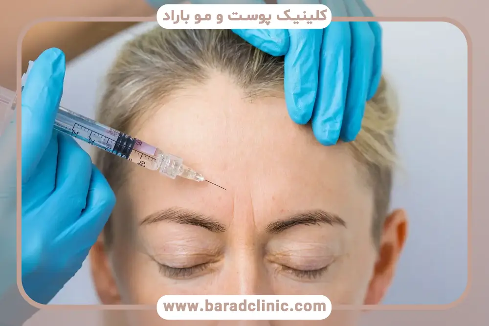 بوتاکس مصپورت