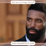 انواع روش کاشت ریش