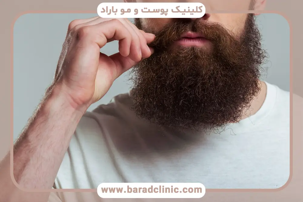 دلایل انتخاب دکتر ریش و سبیل تهران