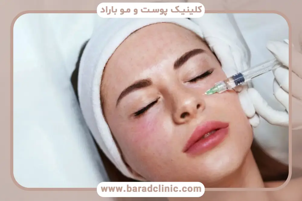 مزوتراپی زیر چشم چگونه انجام میشود؟ بررسی کاندیدای مناسب