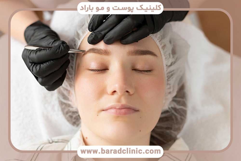 کاشت ابرو اقساطی قلهک