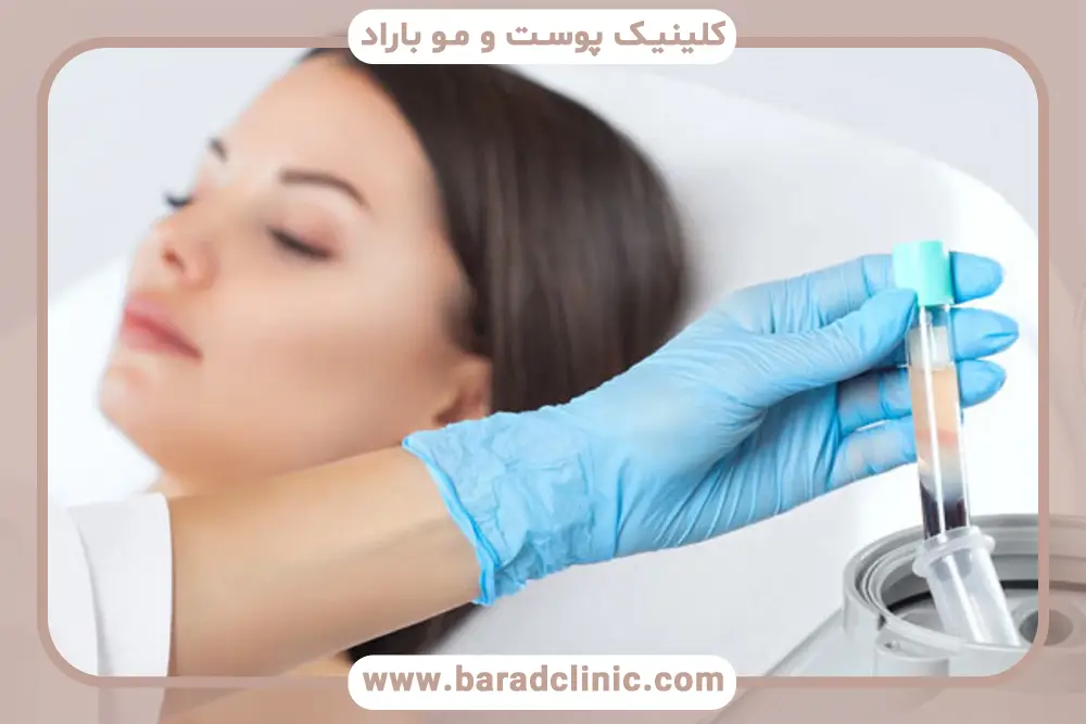 آیا prp دائمی است؟ بررسی اثرگذاری