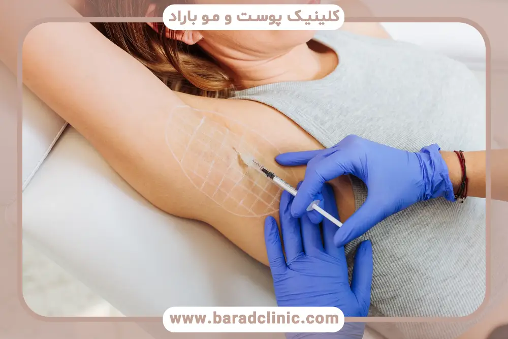 مزایای بوتاکس زیر بغل