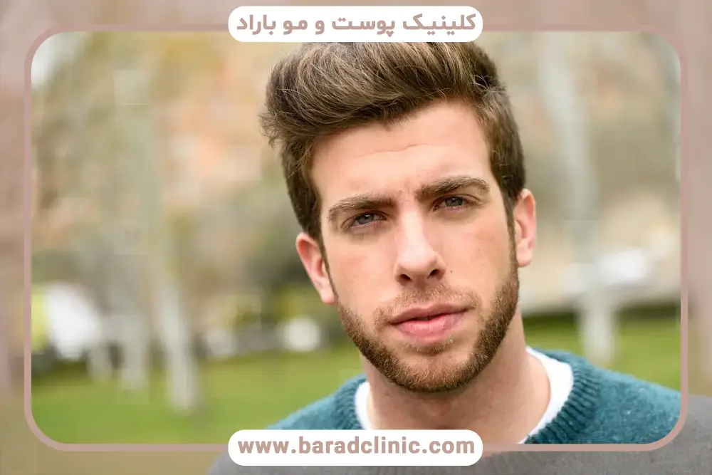 روش‌های نوین در بهترین مرکز کاشت ریش طبیعی در تهران