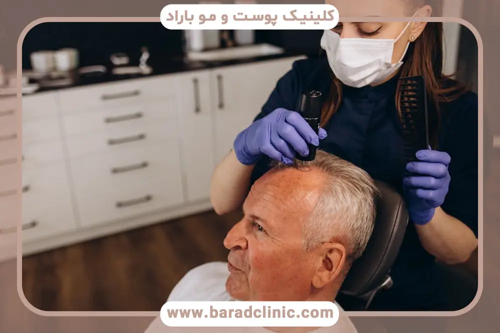 محدودیت‌های سنی کاشت مو پشت سر