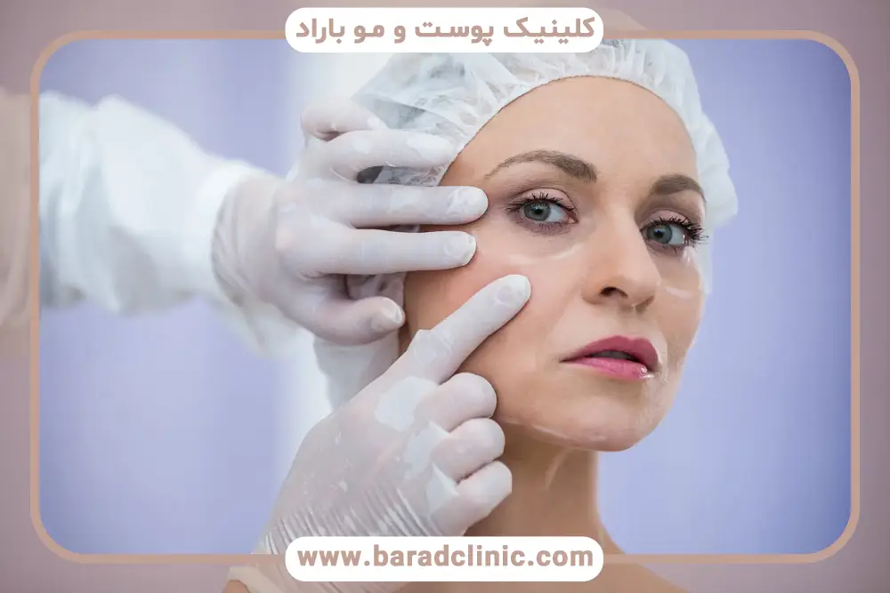 برش ترکیبی از انواع تکنیک های برش در بلفاروپلاستی