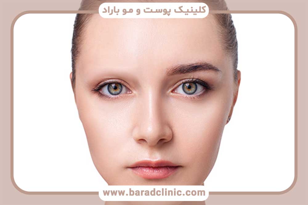 کاشت ابرو قسطی در تهران