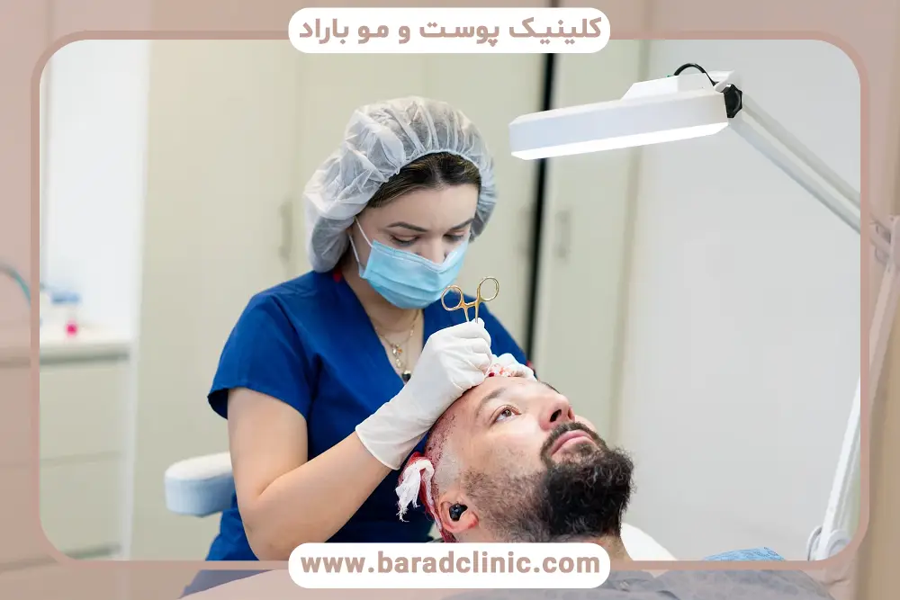 کاشت فولیکول‌ها در فیلم کاشت مو از اول تا اخر