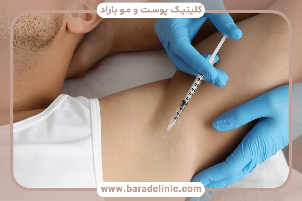 تغییرات بعد از بوتاکس زیر بغل