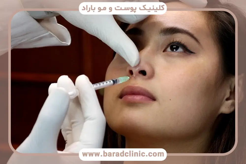 تفاوت بوتاکس بینی و جراحی