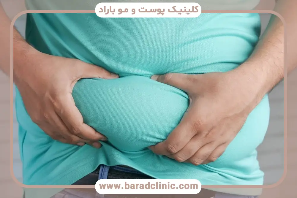 تجربه مصرف کنندگان قرص لاغری ناف