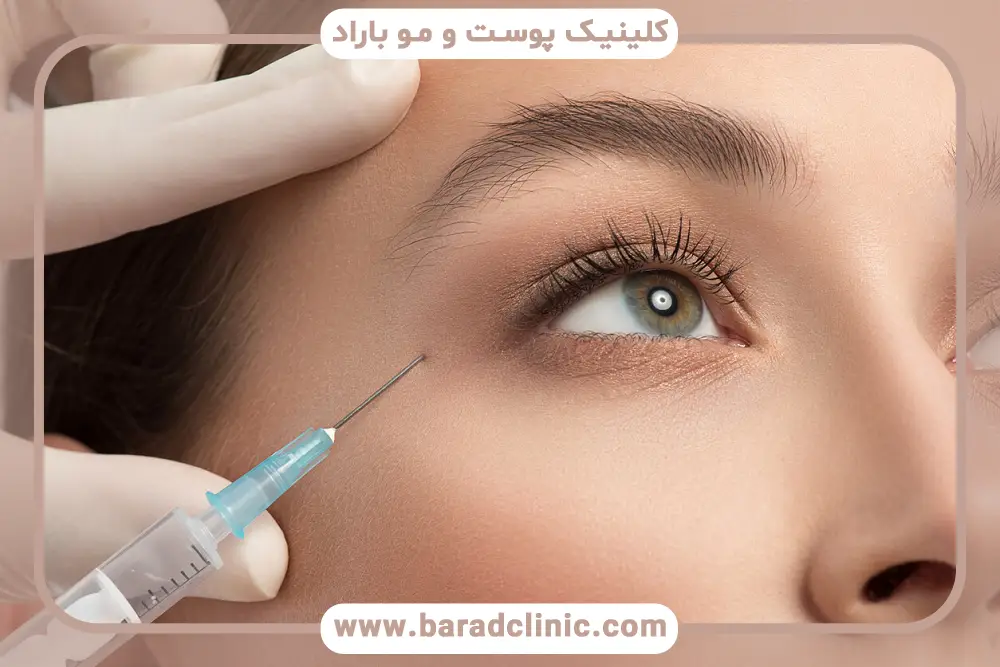 مراقبت‌های قبل و بعد بوتاکس ابرو 