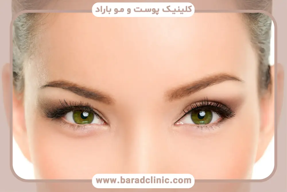 عوارض احتمالی عمل زیبایی چشم بادامی