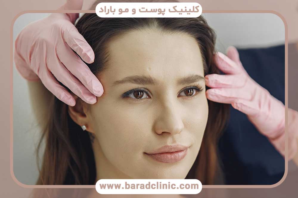 کاشت ابرو اقساطی بهترین کلینیک شمال تهران