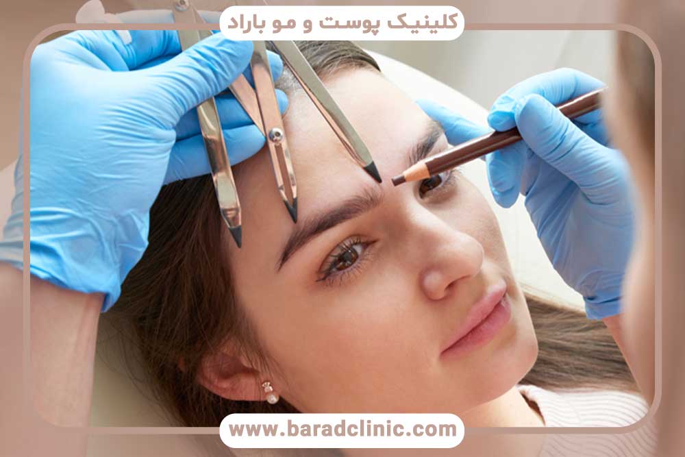 ترمیم کاشت ابرو