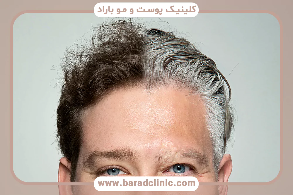 چه عادت هایی مو را زودتر پیر میکند